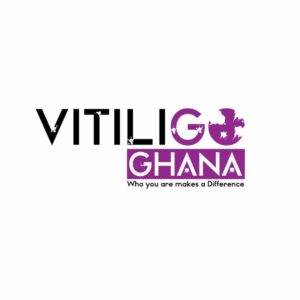 Vitiligo-Ghana-Foundation_logo_vipoc.jpg