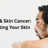 Vitiligo & Skin cancer