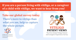 Vitiligo Patient Views survey